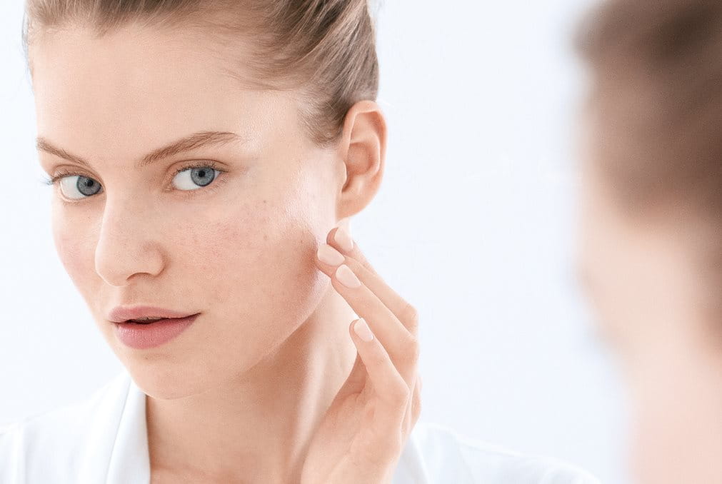 Voici comment vous débarrasser des points noirs