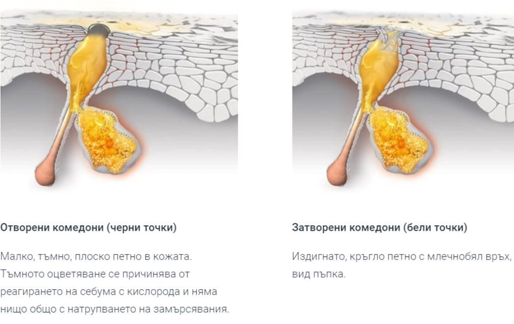 черни и бели точки