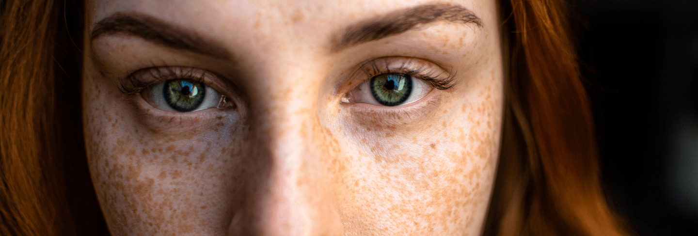 Girl with freckles on face