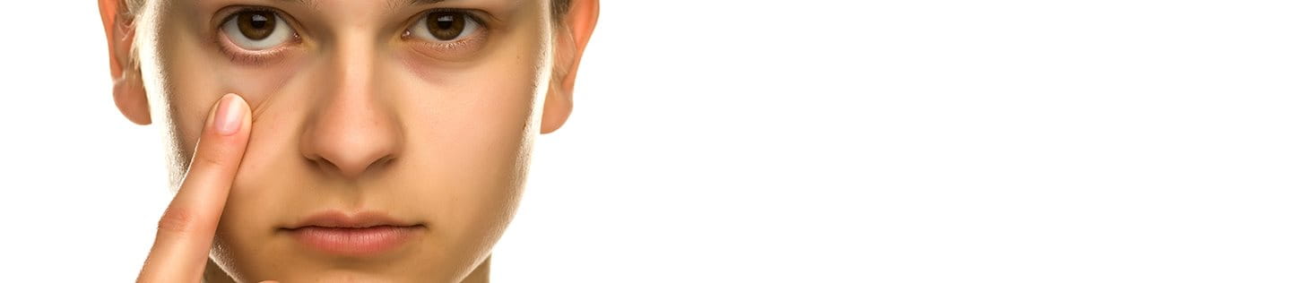 Occhiaie scure e borse sotto gli occhi