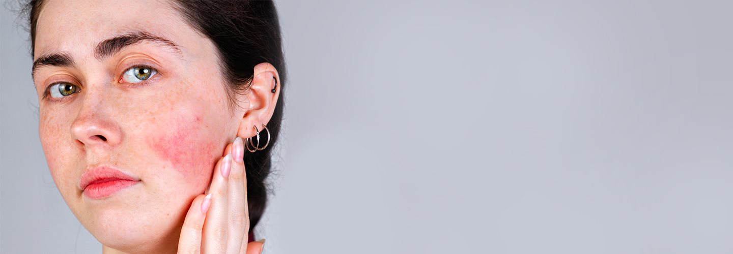 macchie rosse sulla pelle senza prurito