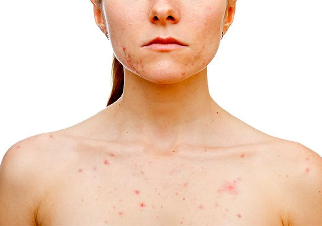 https://images-us.eucerin.com/~/media/eucerin%20relaunch%20media/eucerin%20relaunch%20media/eucerin/local/it/i-nostri-consigli/dermatite-atopica/dermatite-da-stress/01_header_mobile_657492006.jpg?utm_source=chatgpt.com