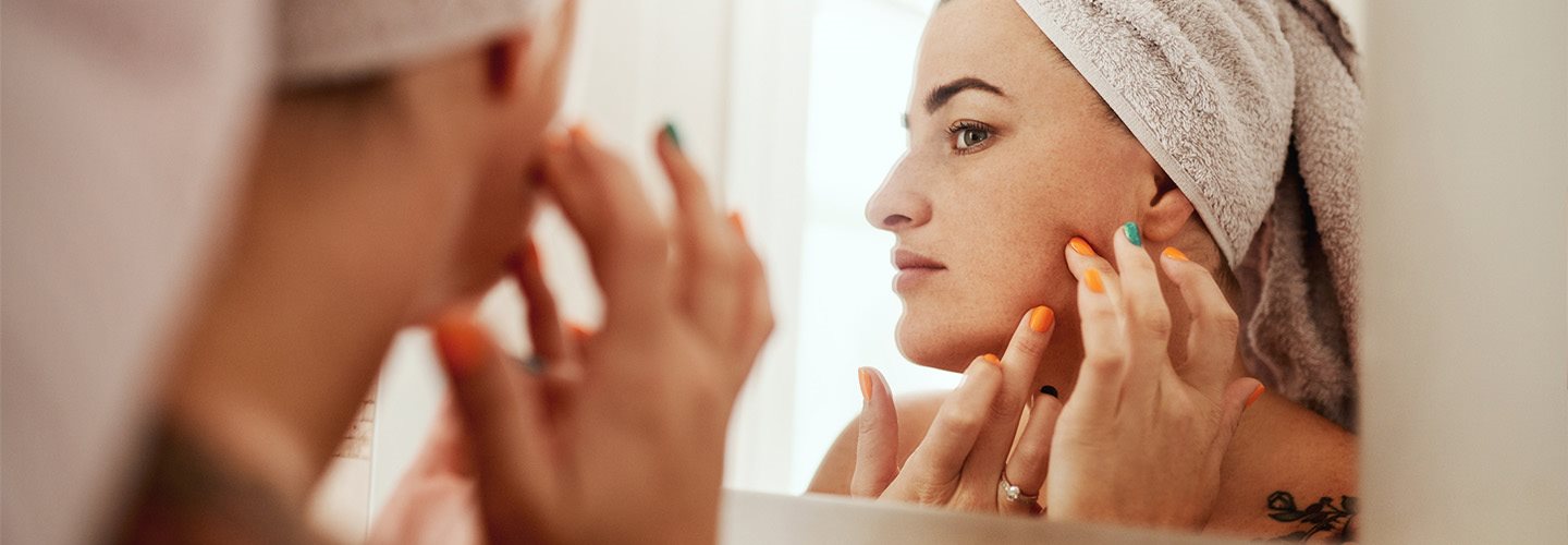 immagine di foruncoli sul mento