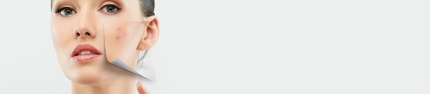 Eruzione cutanea: cause e rimedi