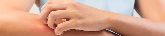 Prurito alle braccia