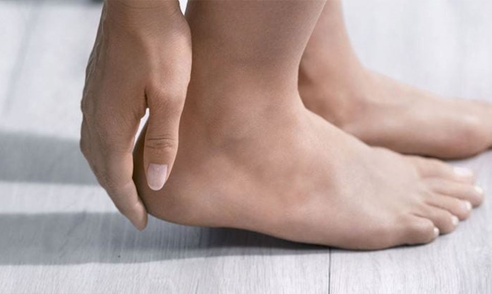 Talloni secchi e screpolati 