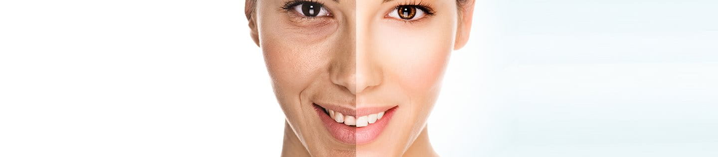 Pelle spenta e grigia