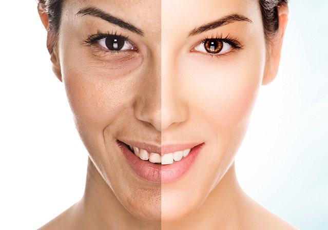 Pelle spenta e grigia