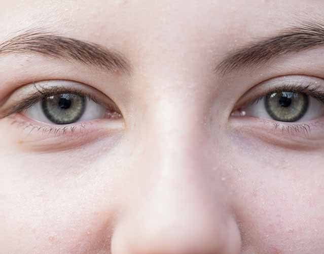 pelle del contorno occhi disidratata
