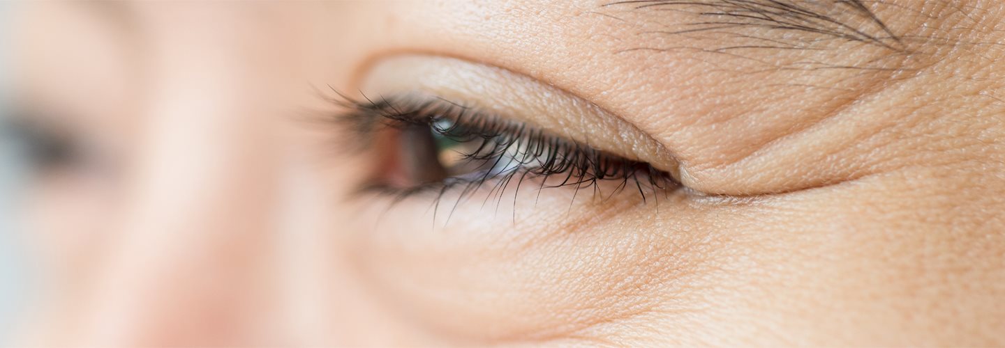 kurze łapki zmarszczki