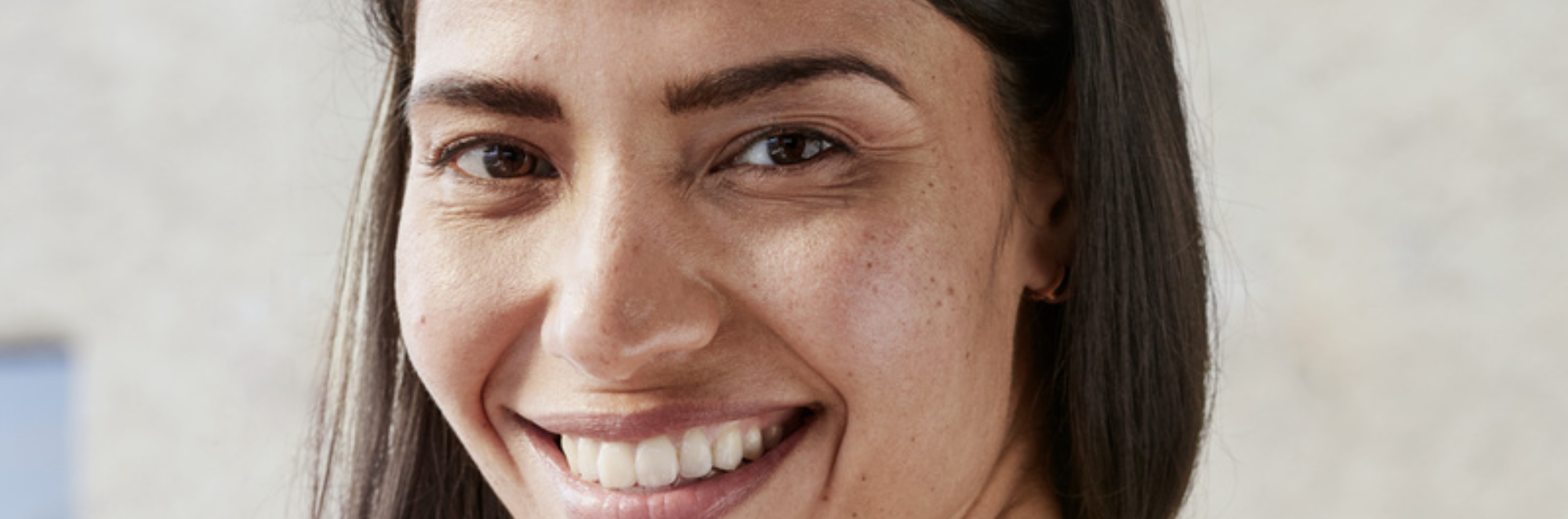 leende kvinna med solfläckar i ansiktet