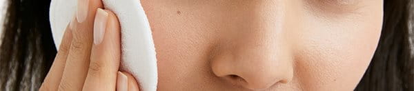 mulher com acne