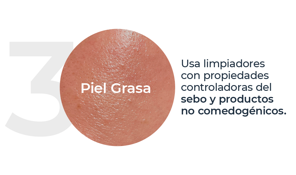 Piel Grasa