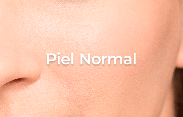 Piel Normal