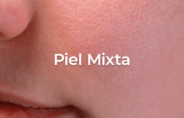 Piel Mixta