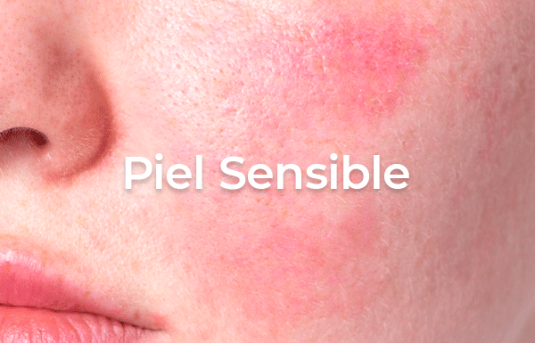 Piel Sensible