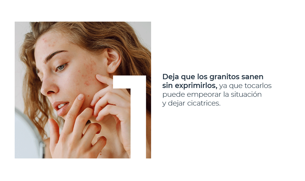 Deja que los granitos sanen sin exprimirlos