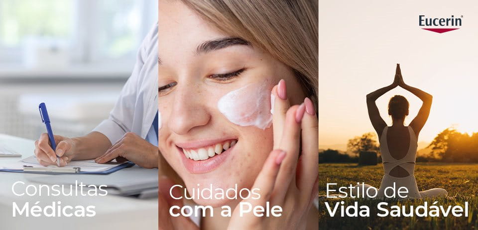 Dicas para controlar a acne hormonal