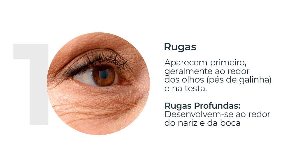 Rugas na pele