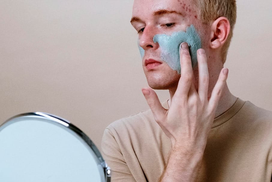 tratamientos-no-medicos-sin-medicacion-para-piel-con-impurezas-propensa-al-acne