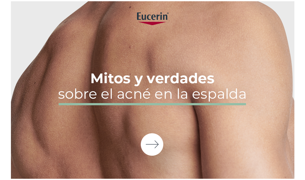 Mitos y verdades sobre acné en la espalda
