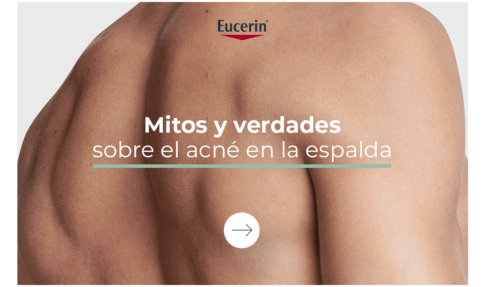 Mitos y verdades sobre acné en la espalda