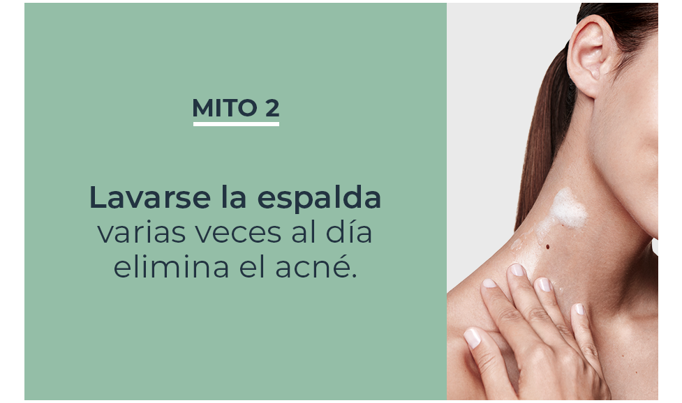 Mitos y verdades sobre acné en la espalda