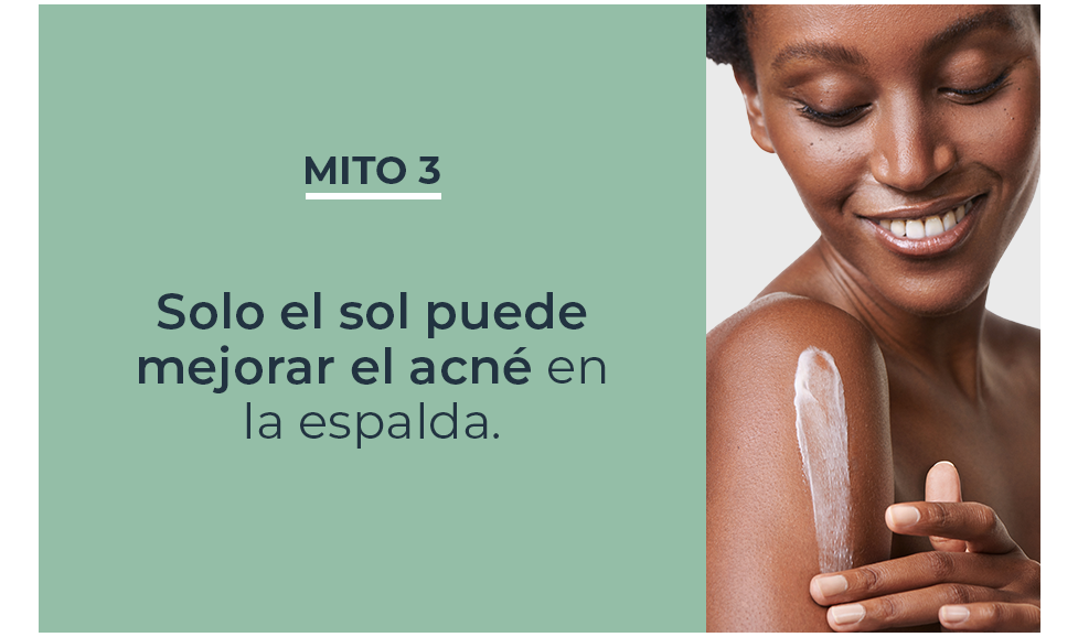 Mitos y verdades sobre acné en la espalda