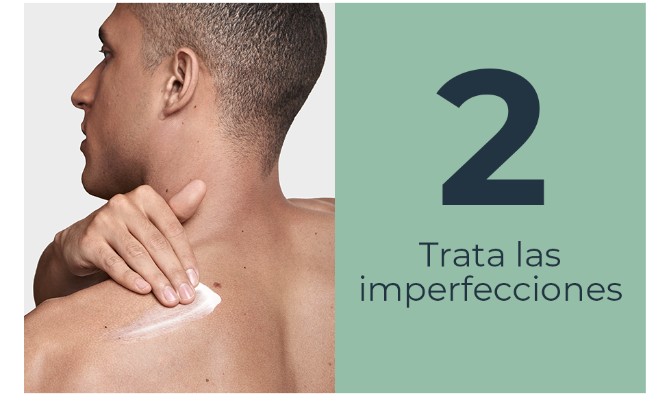 Trata las imperfecciones