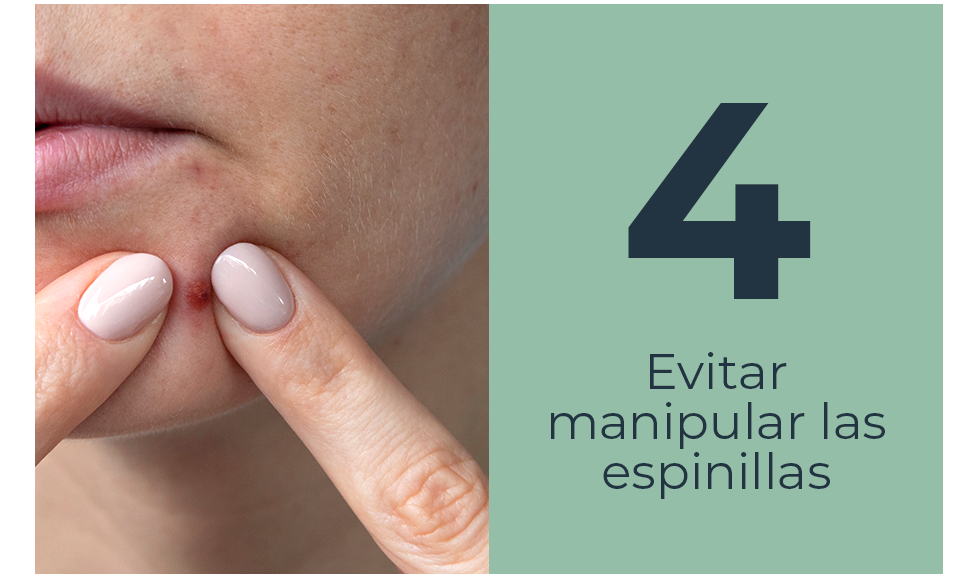 Evitar manipular las espinillas