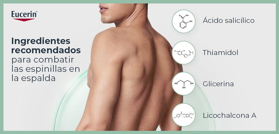Ingredientes para combatir espinillas en la espalda