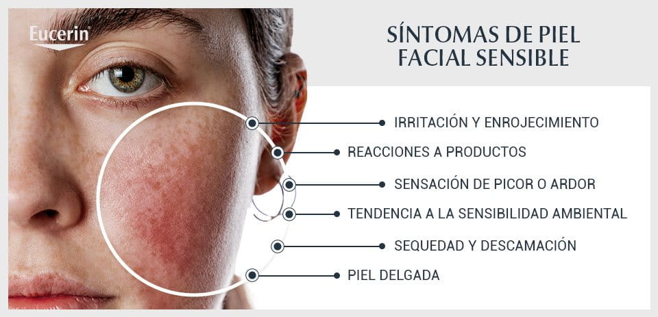 Sintomas de la piel del rostro sensible