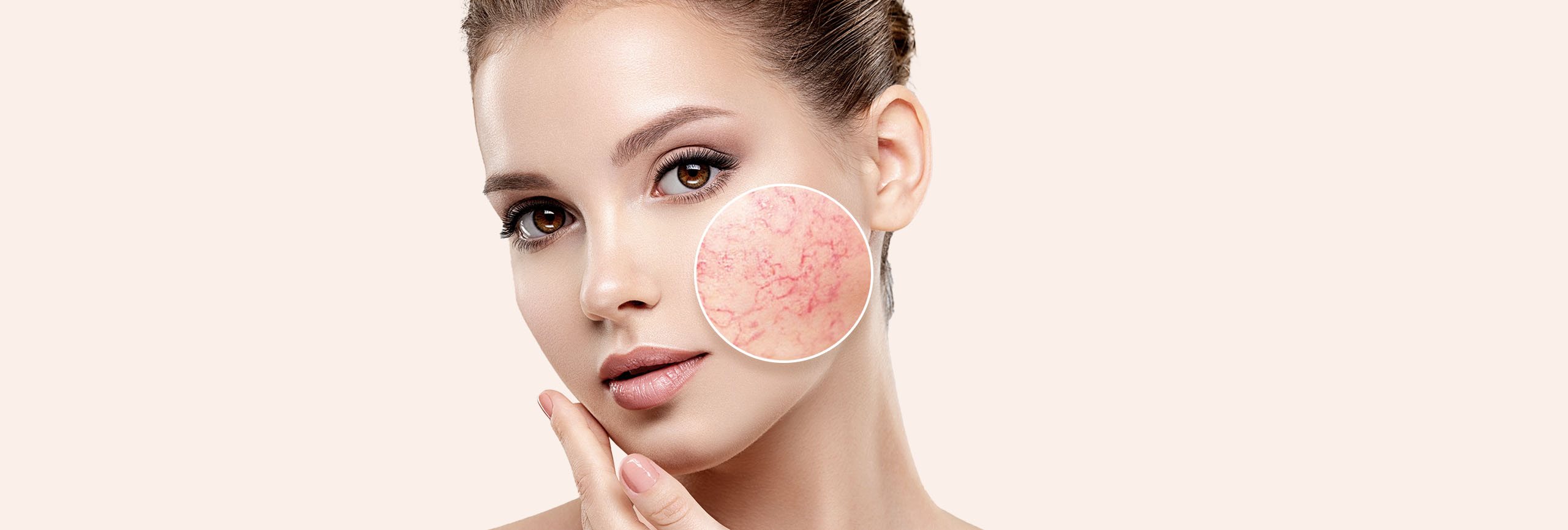 Chica con la piel del rostro sensible