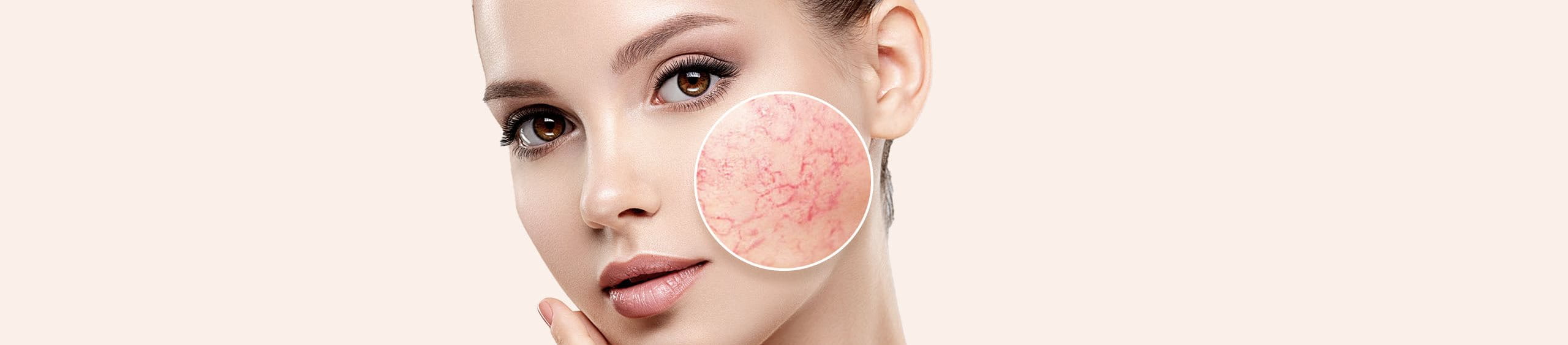 Chica con la piel del rostro sensible