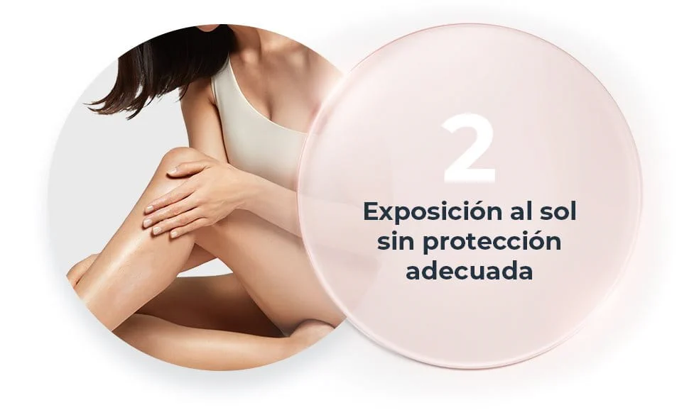 Exposición al sol sin protección adecuada