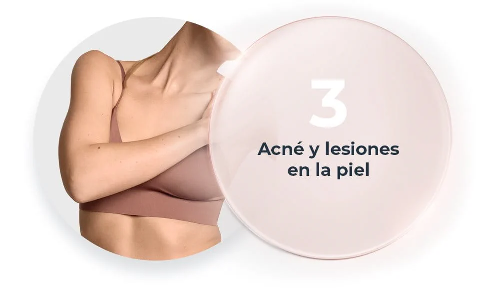Acné y lesiones en la piel