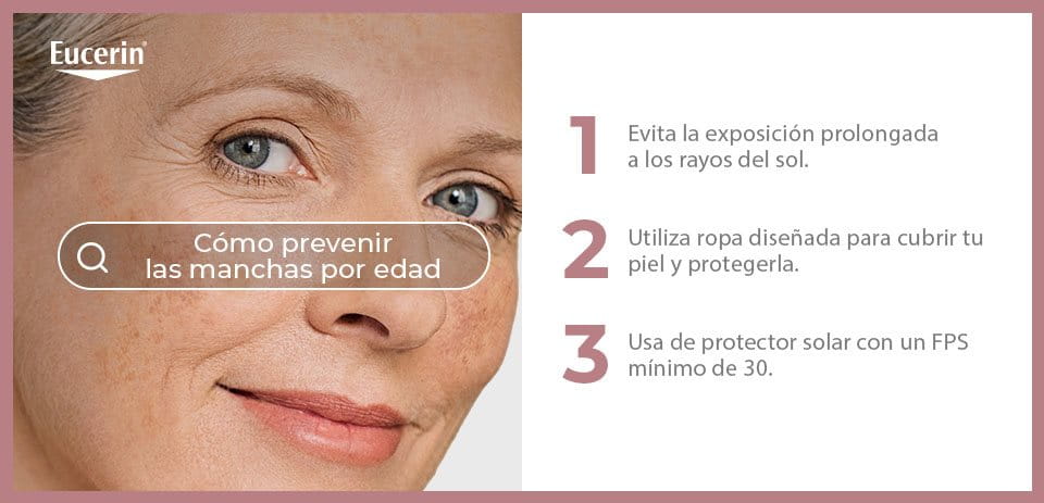 Causas de las manchas por la edad