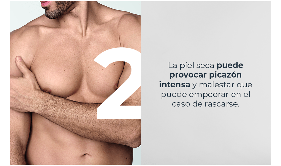 Piel seca puede provocar picazón intensa