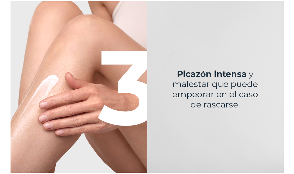 Picazón intensa empeora al rascarse