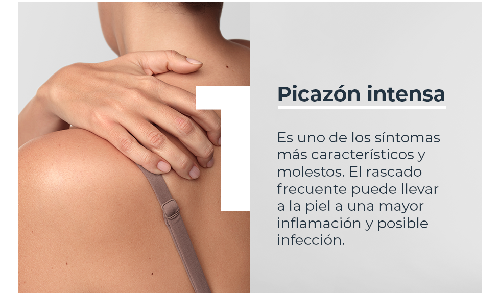 Picazón intensa
