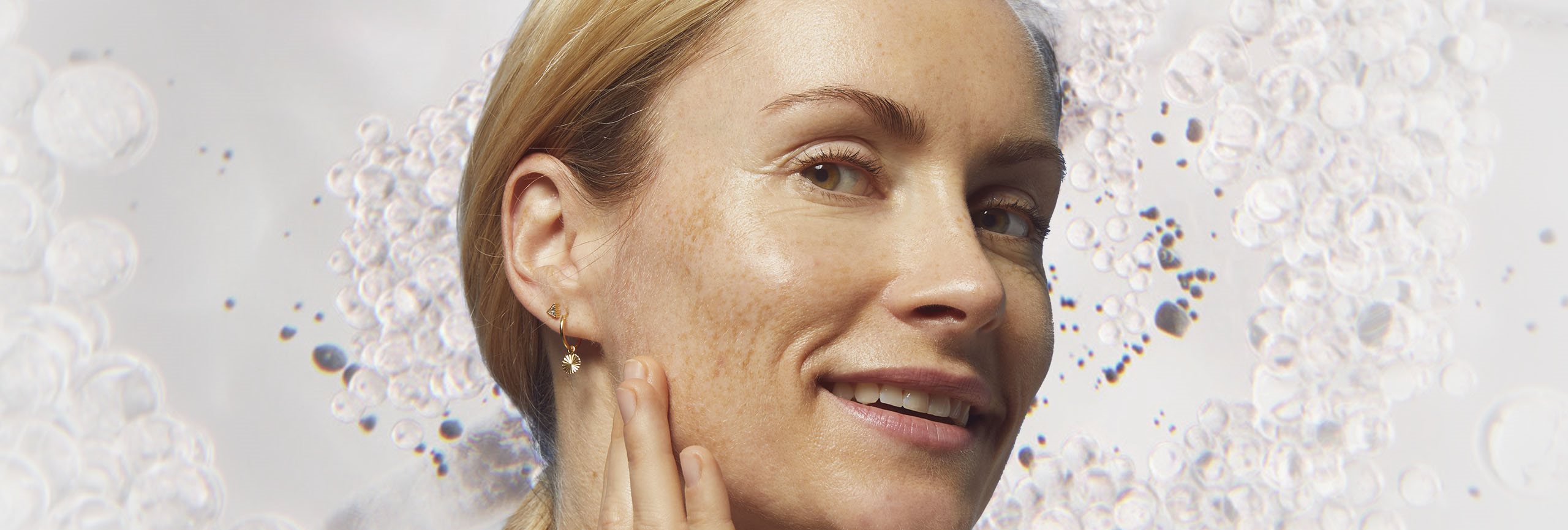 Prevenir la hiperpigmentación facial