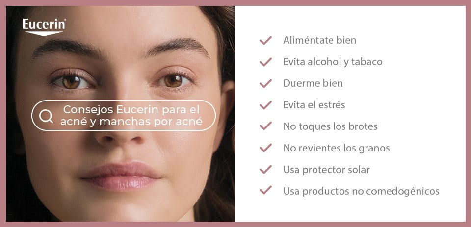 Eucerin para el acné y manchas por acné