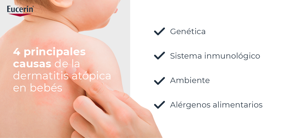 Causas de la dermatitis atópica en bebés