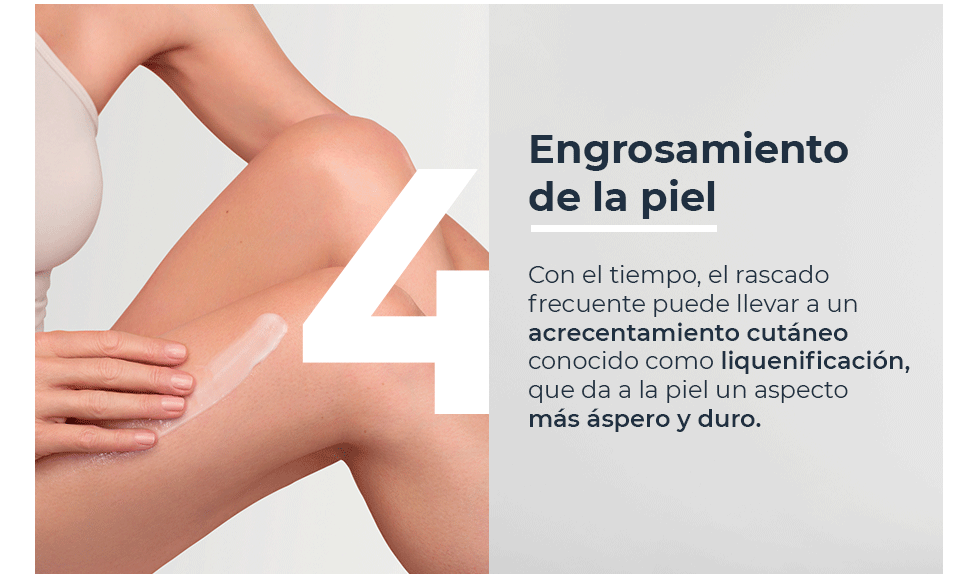 Engrosamiento de la piel