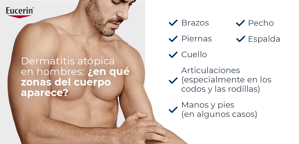 ¿Qué es dermatitis en hombres?