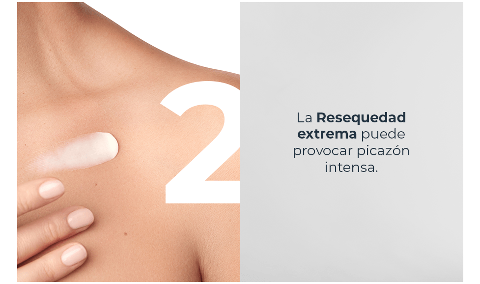 La resequedad extrema puede provocar picazón