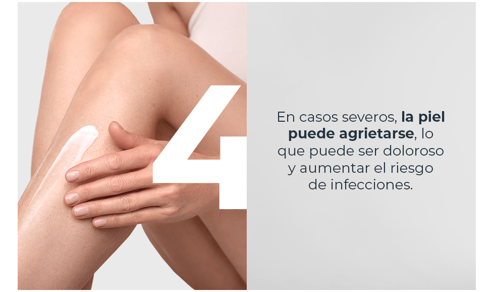 La piel puede agrietarse