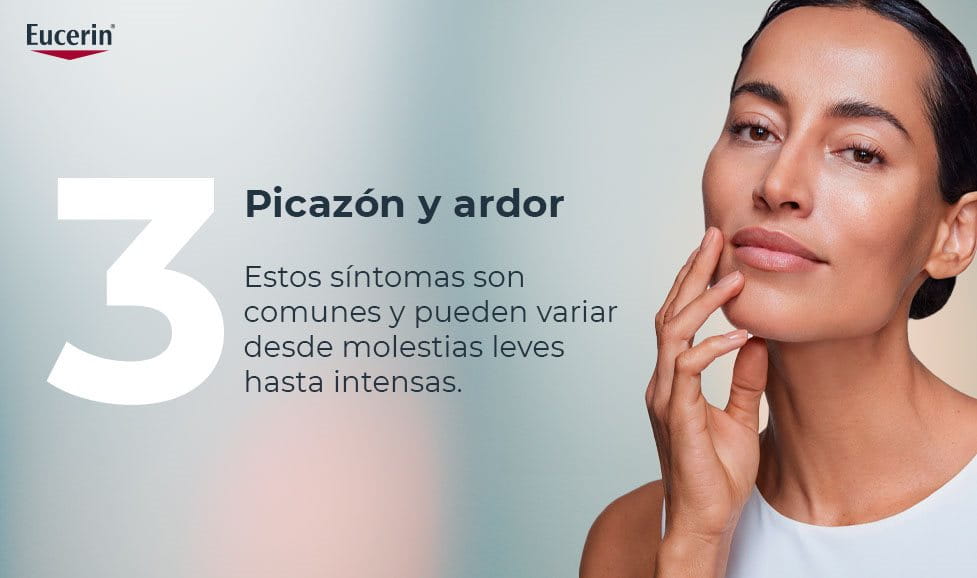 Picazón y ardor