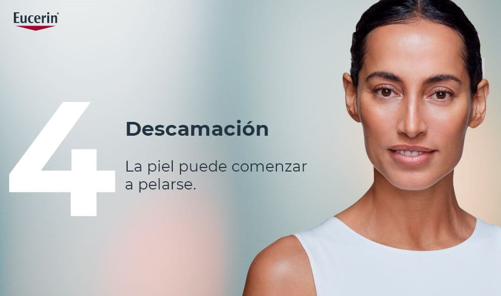 Descamación