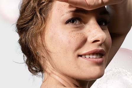 Manchas en la piel causadas por el sol